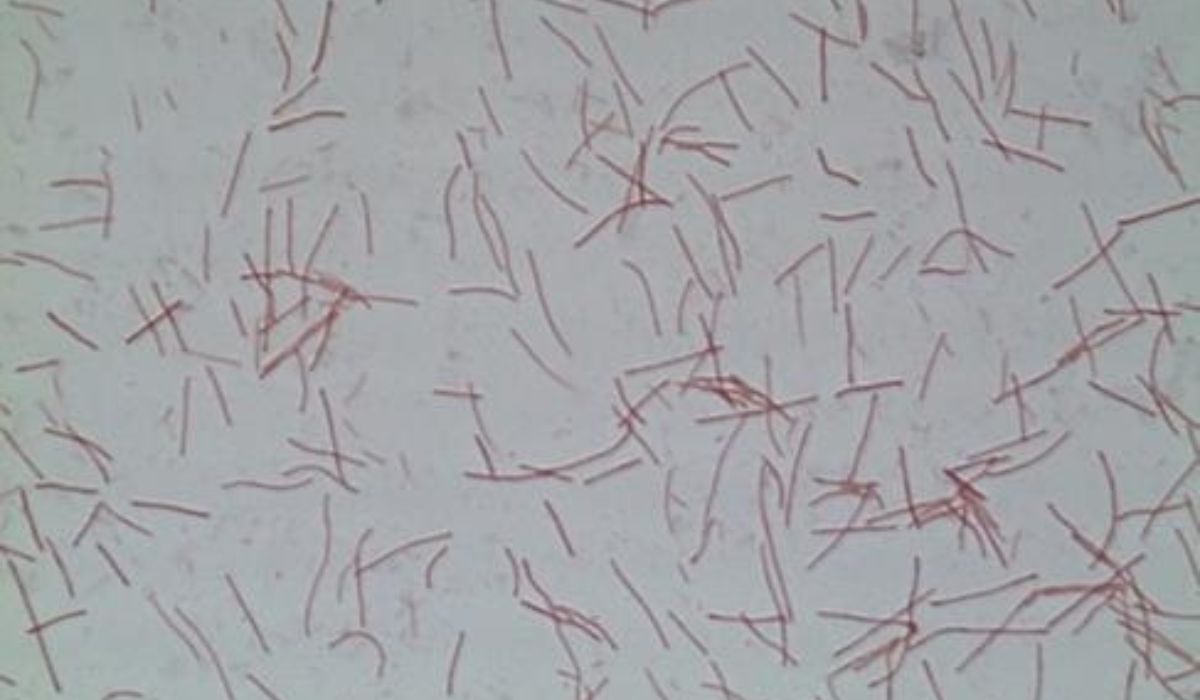 Desarrollan protocolo experimental reproducible para estudiar tenacibaculosis