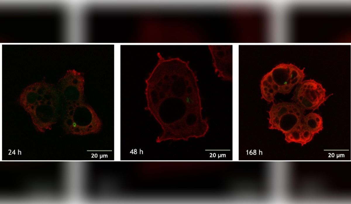 Amebas de vida libre y su rol en la transmisión de Piscirickettsia salmonis