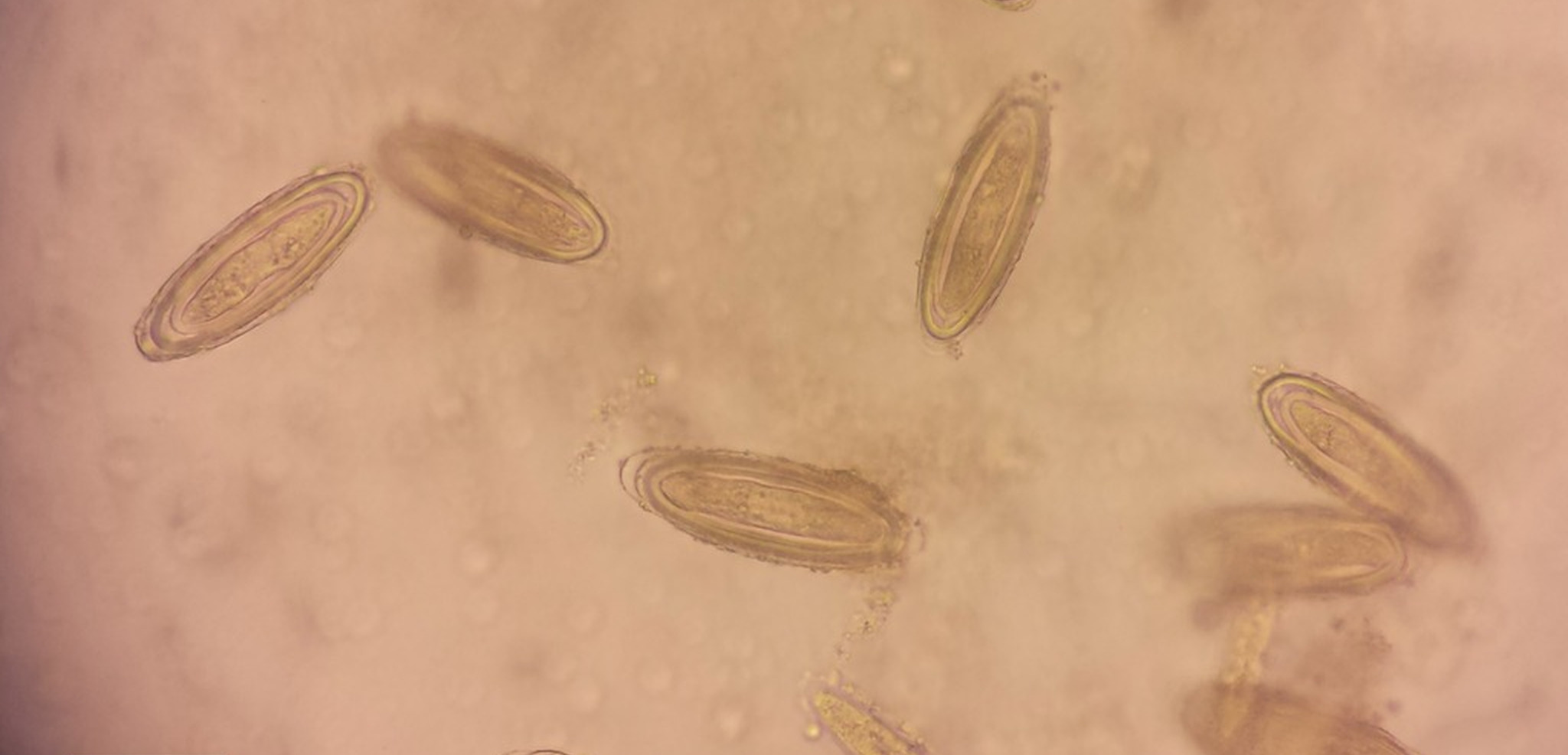 Investigación propone innovador método para estudiar parásitos en ecosistemas marinos